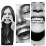 SCM Bellecour - L'implant dentaire : Comment ca fonctionne ?