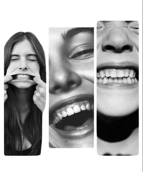 SCM Bellecour - L'implant dentaire : Comment ca fonctionne ?