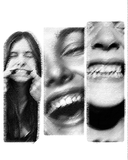 SCM Bellecour - les implants dentaire