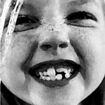 SCM Bellecour - les dents de lait