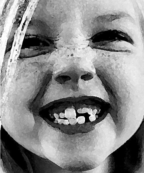 SCM Bellecour - les dents de lait