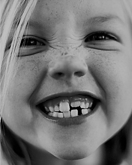 SCM Bellecour - les dents de lait