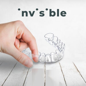 SCM Bellecour : Aligneurs transparents